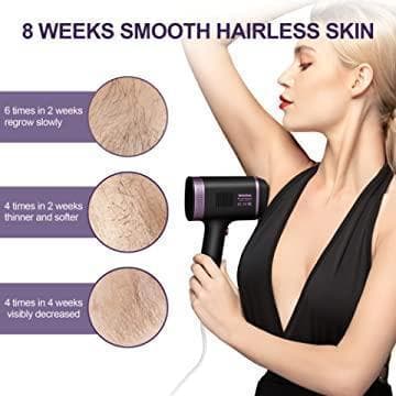 脱毛器 冷却脱毛