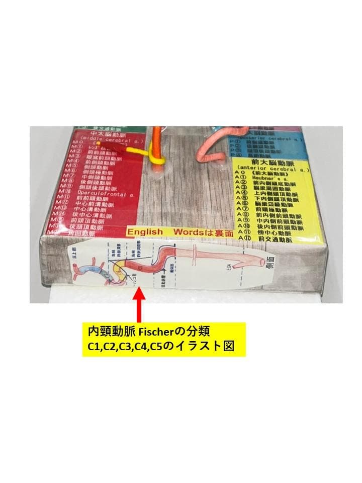脳血管模型　教育説明用（脳血管模型が必要な人のために）