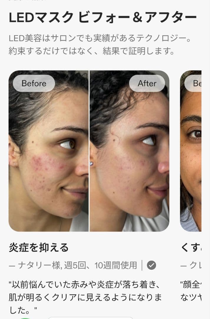 ボディ・フェイスケア R