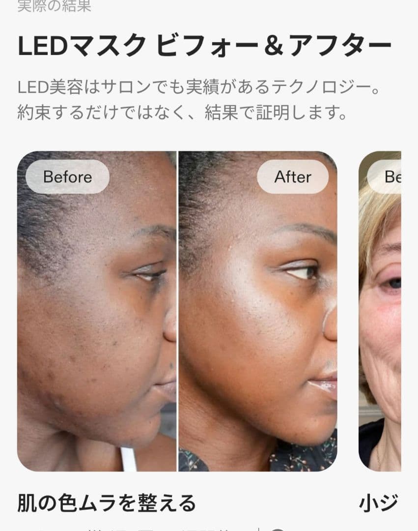 ボディ・フェイスケア R