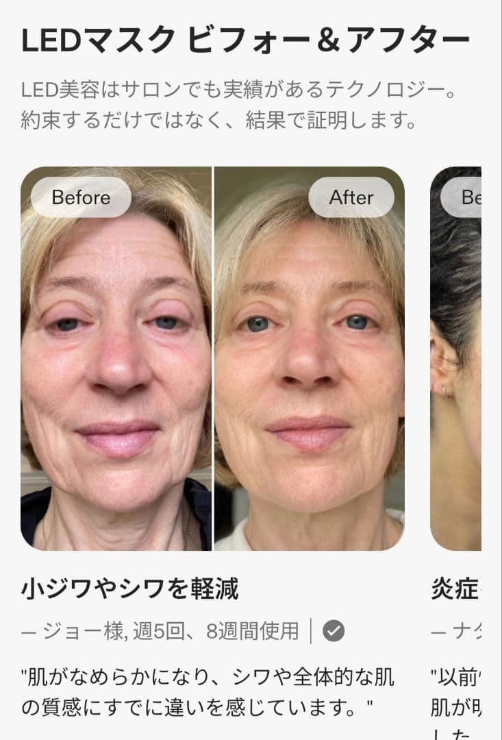 ボディ・フェイスケア R