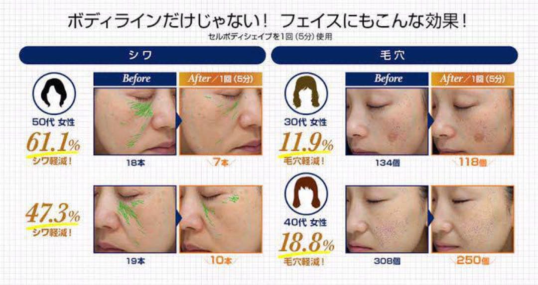 【ピンク】TBC防水セルボディシェイプ美顔器EMSラジオ波RF脂肪リンパ筋肉