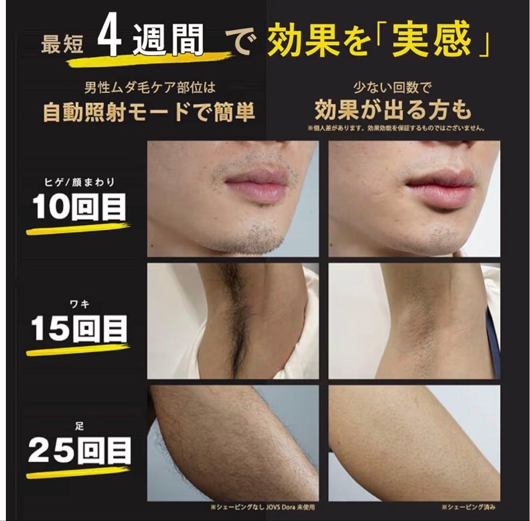 JOVS Dora SRモード脱毛器 新品未開封