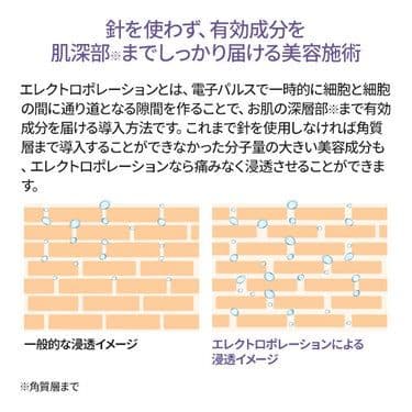 エレクトロポレーション美顔器 HD：(セブンビューティー)