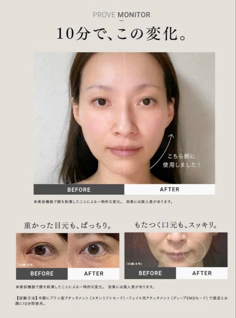 MYTREX PROVE 美顔器 ブラック