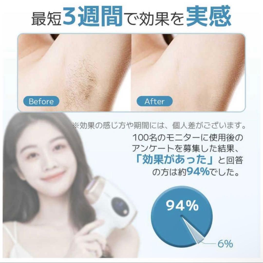 サー リシ脱毛器 IPL光美肌脱毛器 脱毛器 脱毛