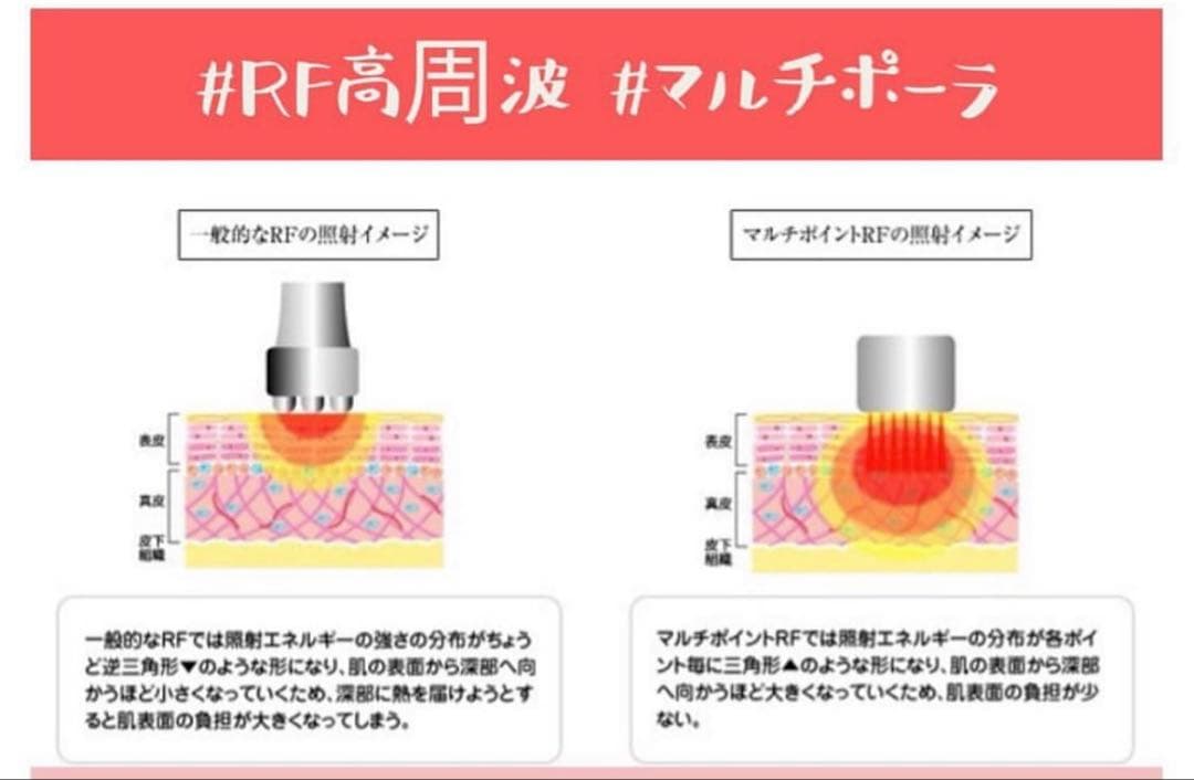 リポセル　RF高周波マシン　エステ業務用
