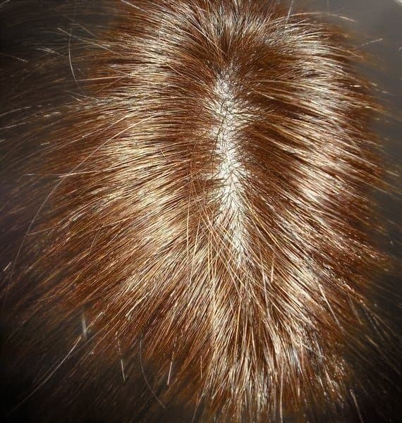 人毛　ウィッグ　中分け人工皮膚付き　ブラウン　スーパーロング　Mサイズ