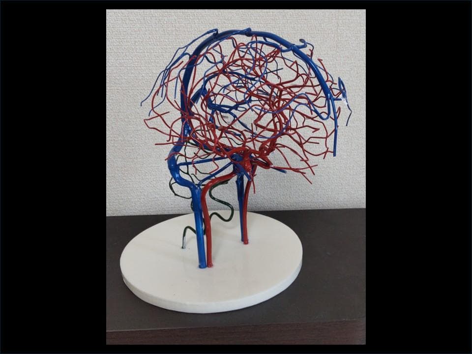 脳血管模型(内頚動脈・椎骨動脈・脳静脈)