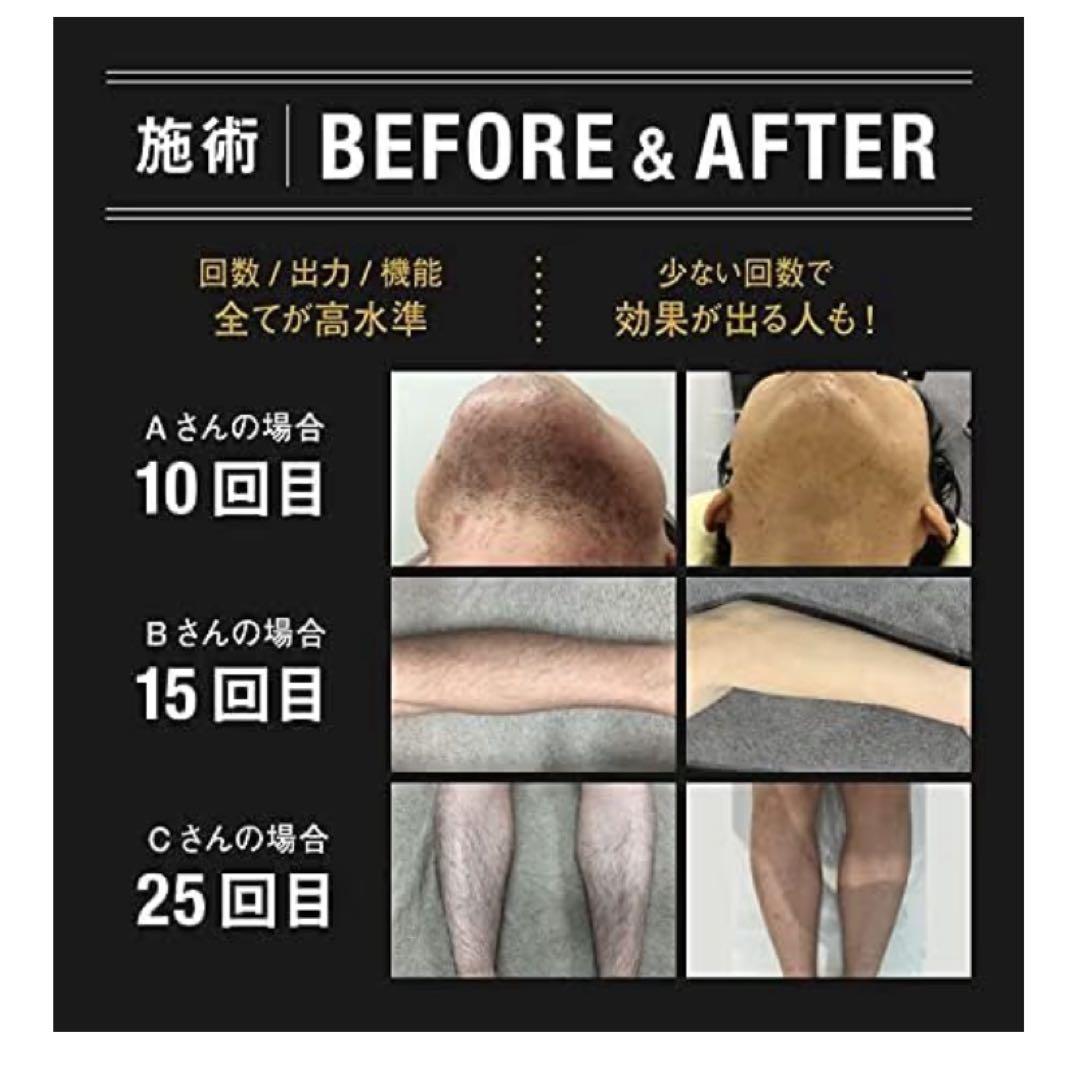 新品未開封 M CLEAR メンズクリア CLEAR 家庭用脱毛器