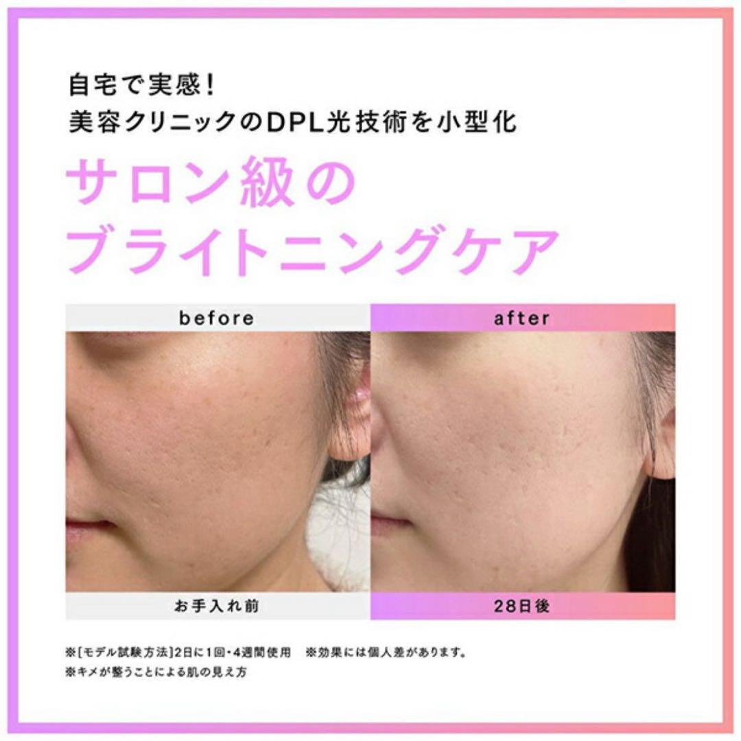 MYTREX MT-MR22-B ブラック MiRAY ミライ 光美容器