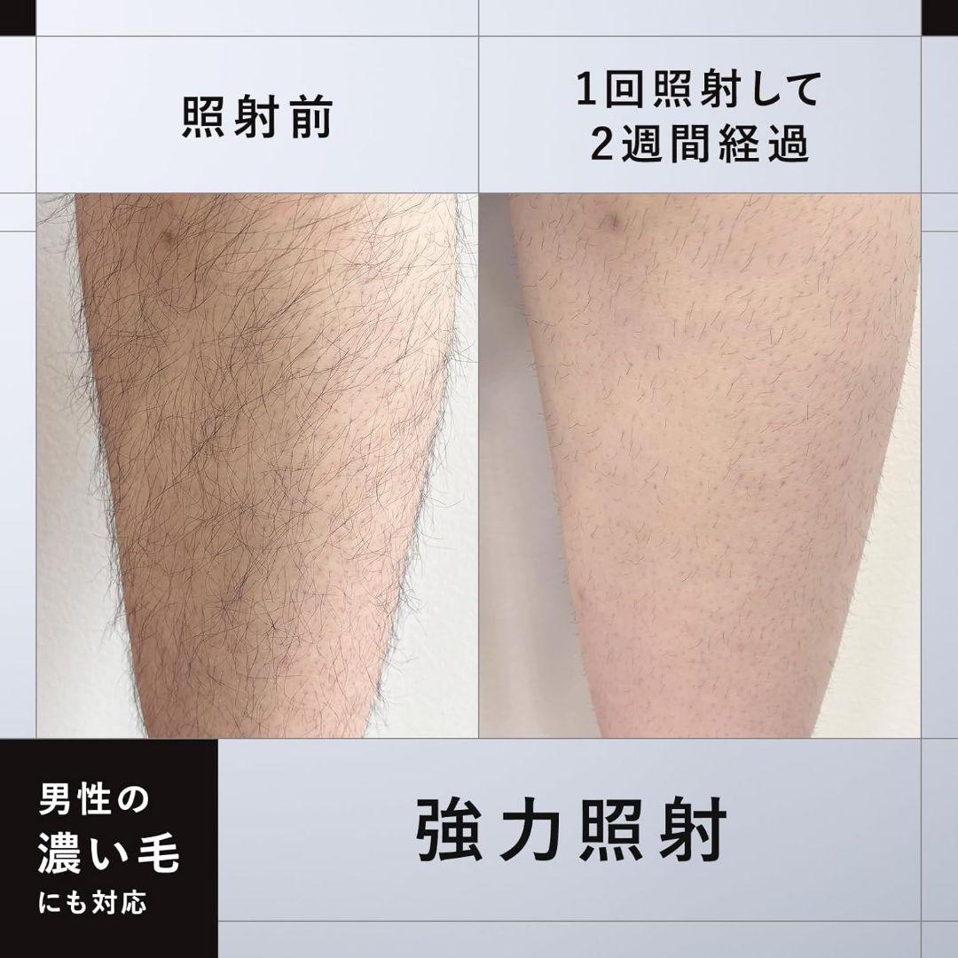 マンダム ium イウム スピードショット SPEED SHOT 脱毛器
