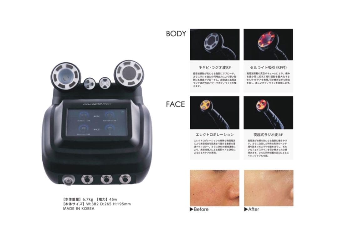 T*M様 CELLZERO FAST セルゼロファスト　エステマシン　じぶんde