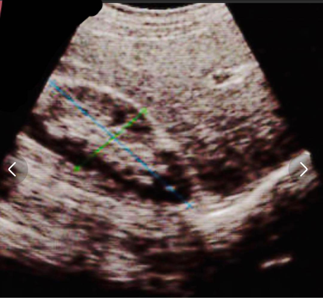 超音波検査装置（エコー）