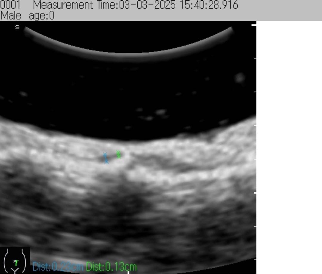 超音波検査装置（エコー）