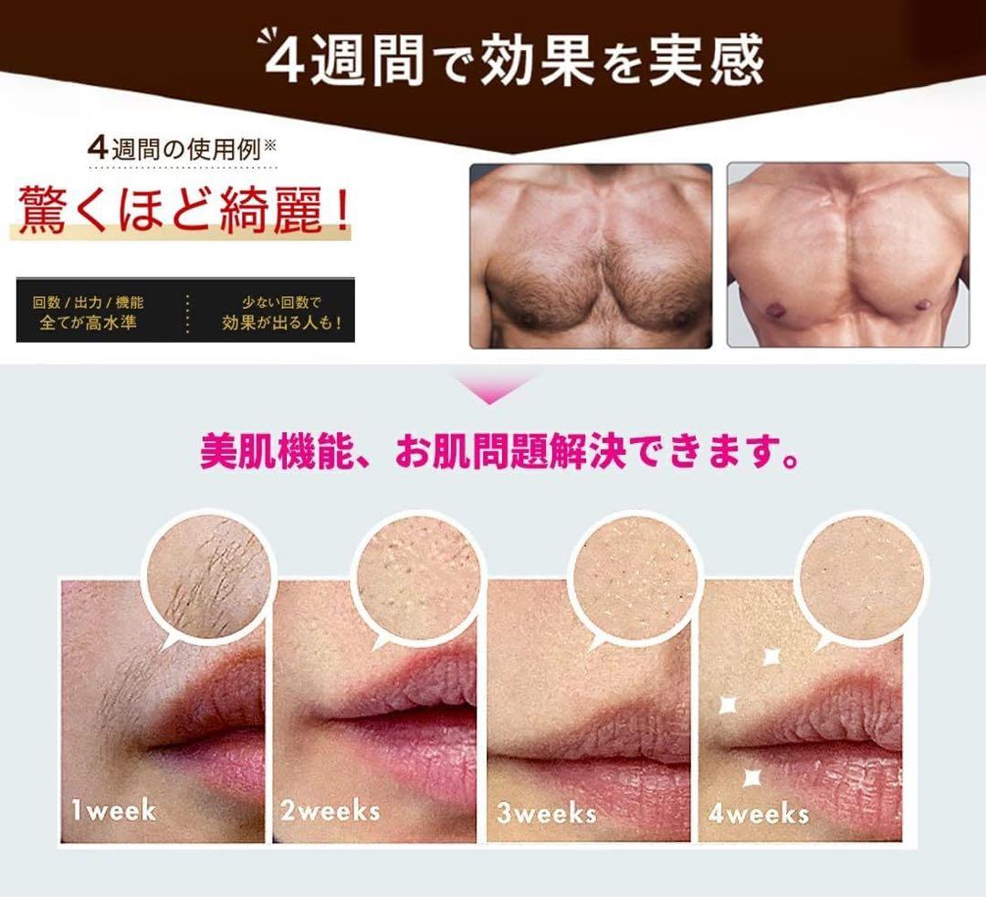 脱毛器 全身脱毛 99万発照射 冷却機能付き 家庭用 5段階レベル調節 説明書付