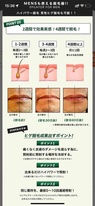 ANYMI脱毛器　プロ仕様