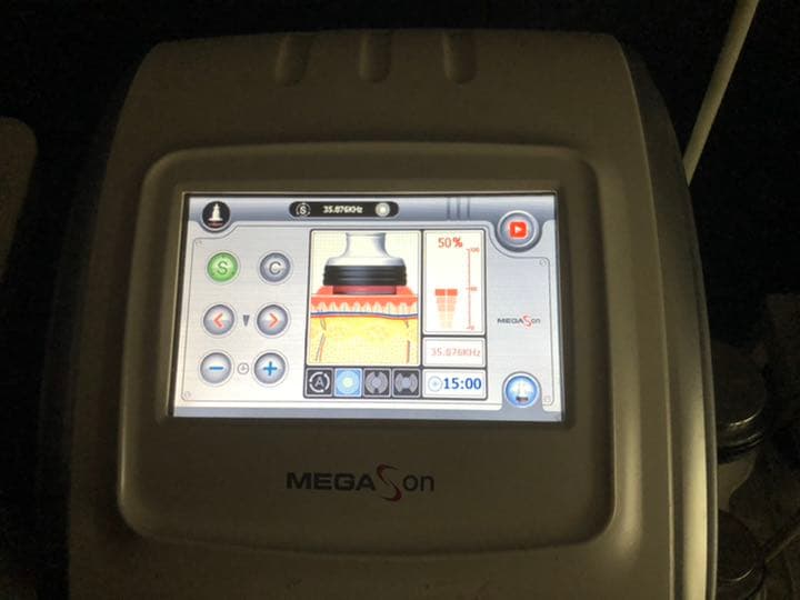 キャビテーション業務用　部分痩身