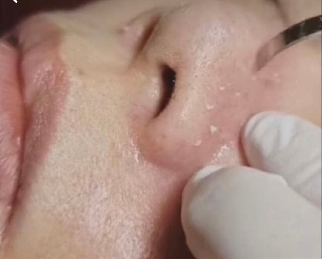 スキンミラクル