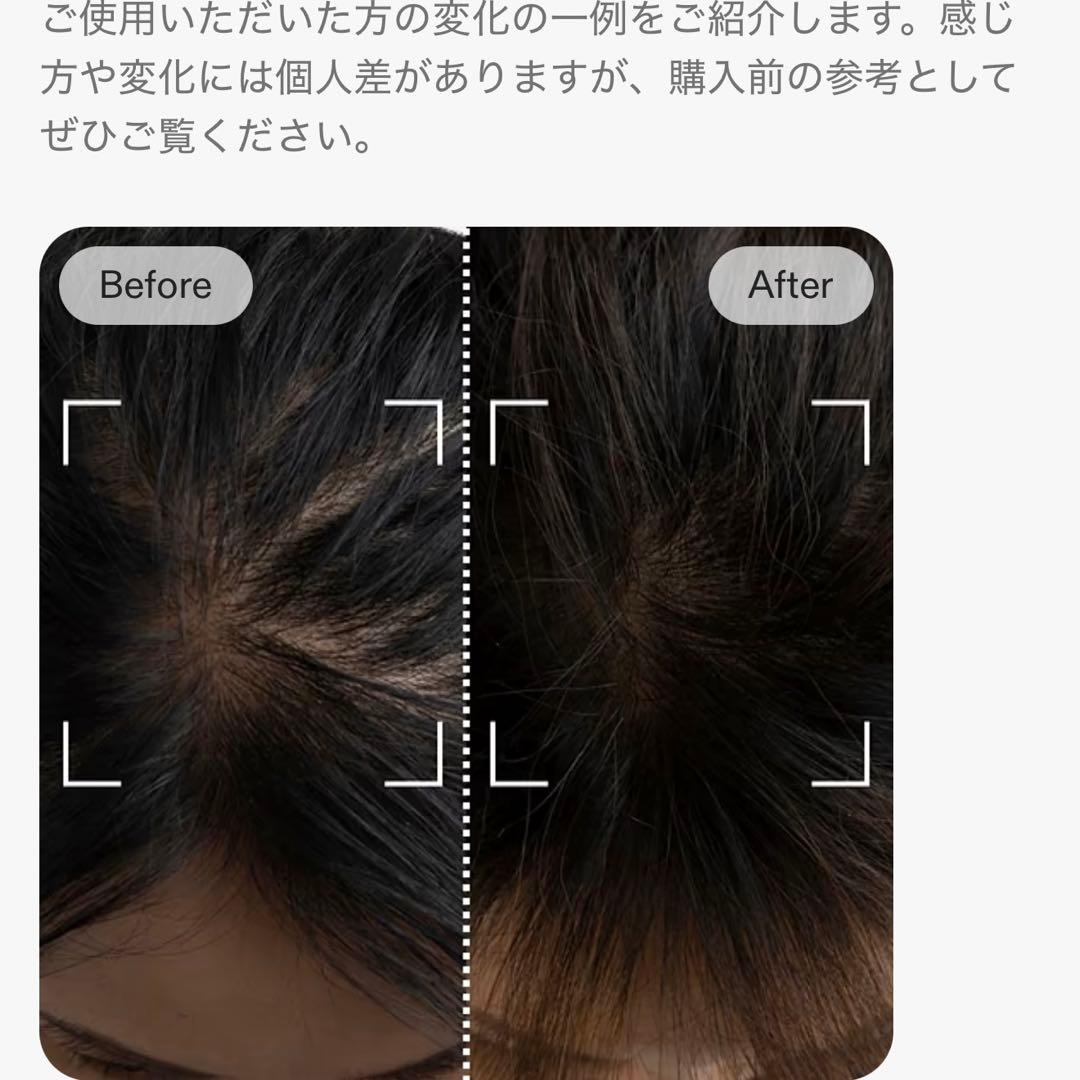 CurrentBody Skin LED頭皮・頭髪ケアデバイス