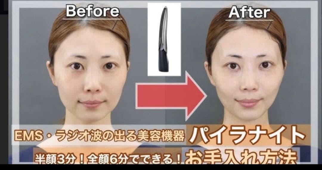 パイラナイトPYR KNIGHT EMSラジオ波美顔器