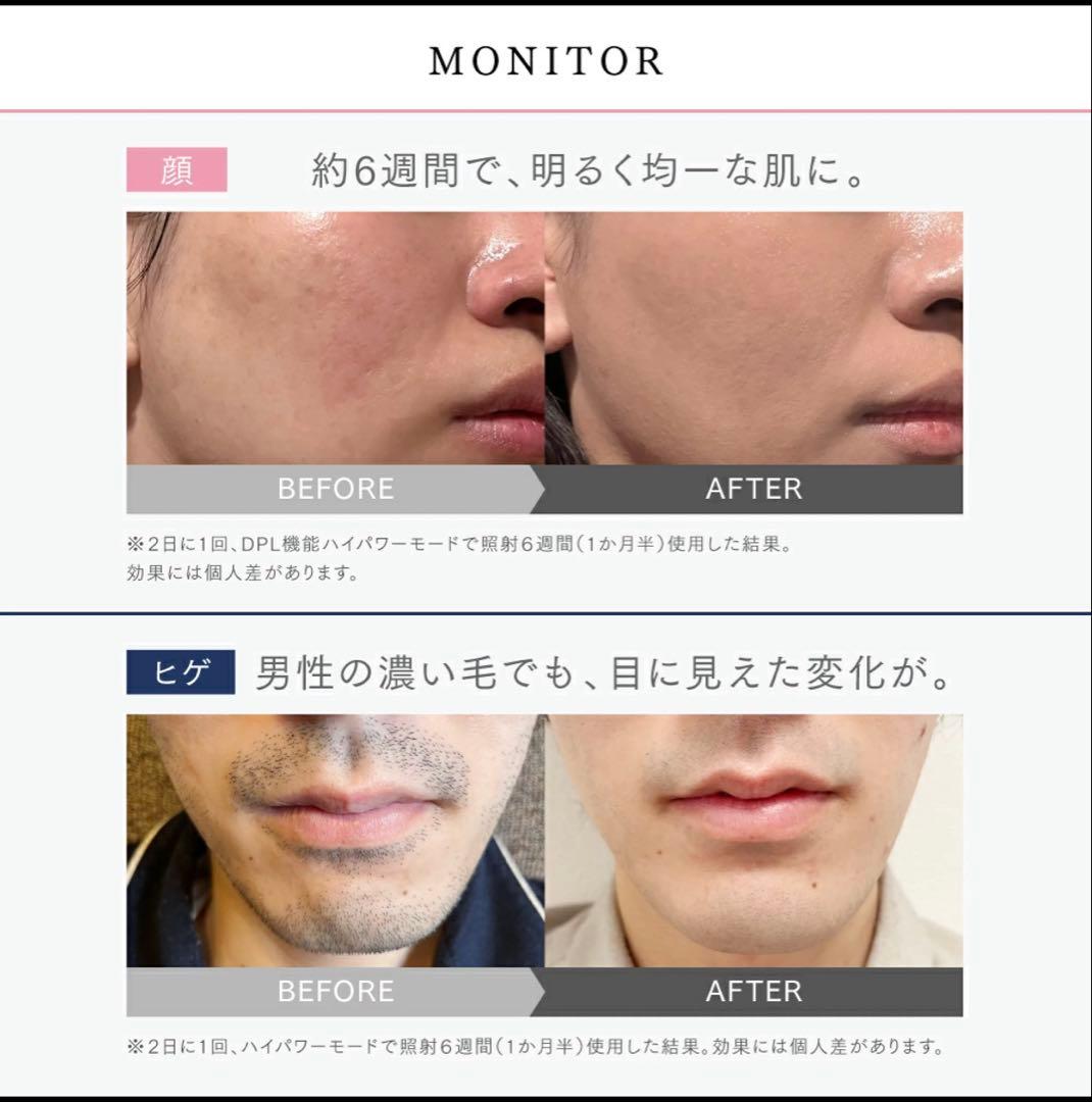 新品未使用品　MYTREX MiRAY 脱毛器　マイトレックスミライ