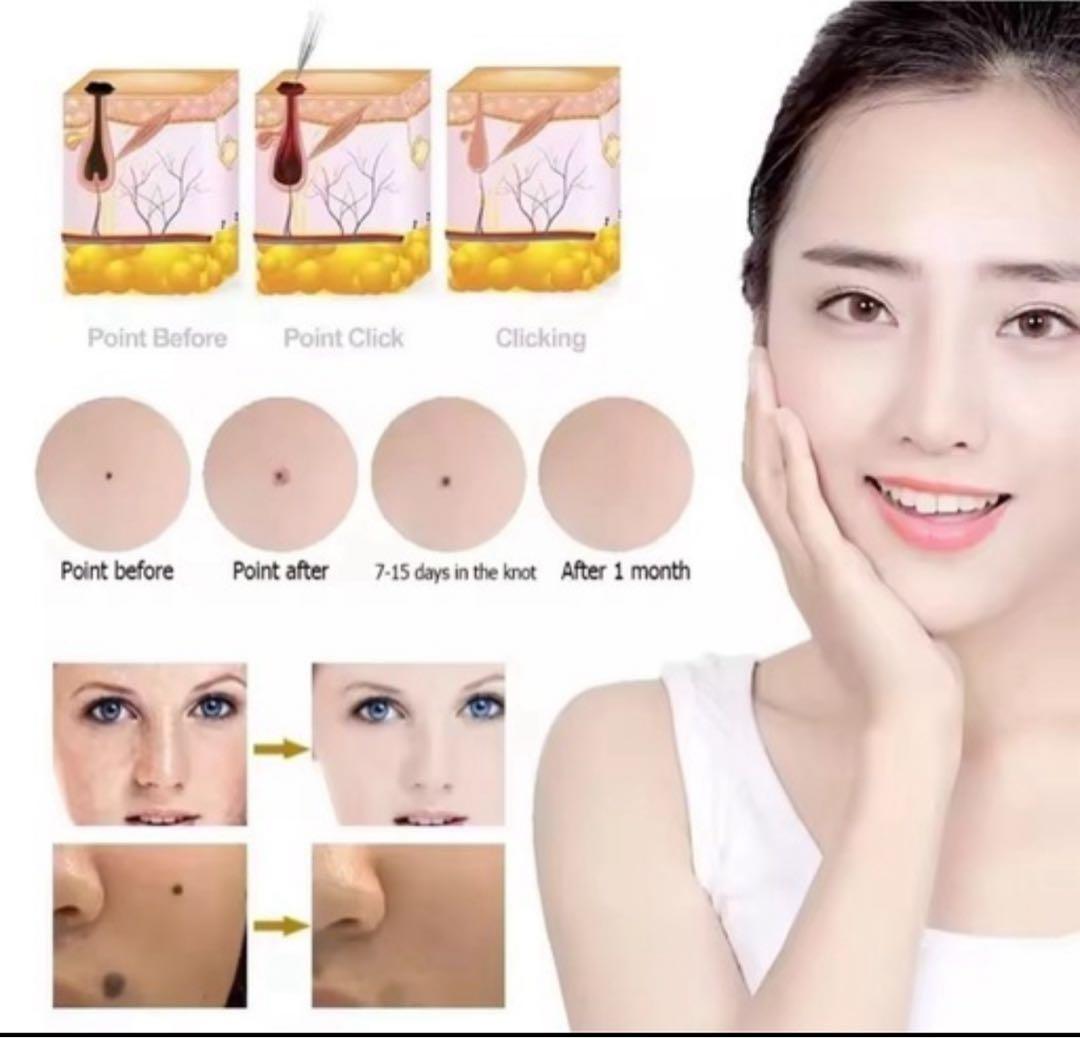 今だけ値下げ中、美容機器　スポットケア