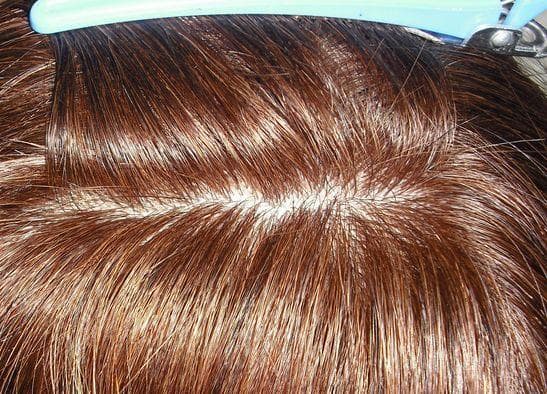 人毛　ウィッグ　人工皮膚付き　ブラウン　スーパーロング　Ｍサイズ