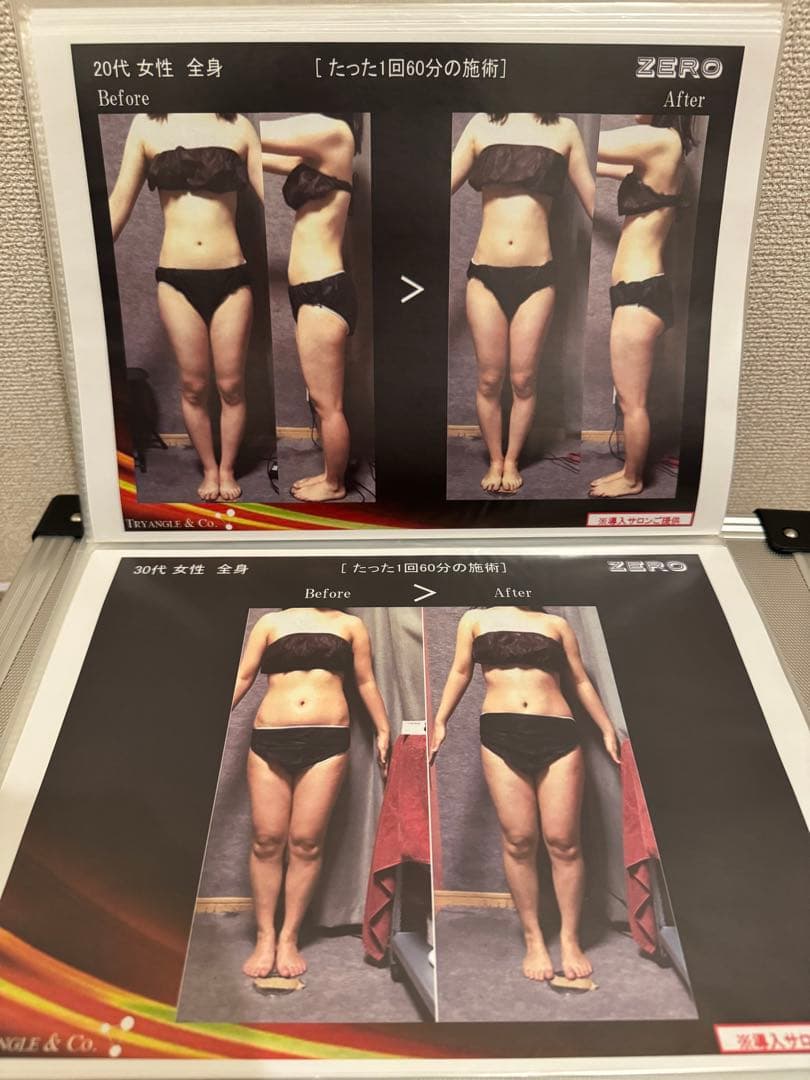 【値下げ】キャビゼロ　caviZERO 業務用 複合痩身機