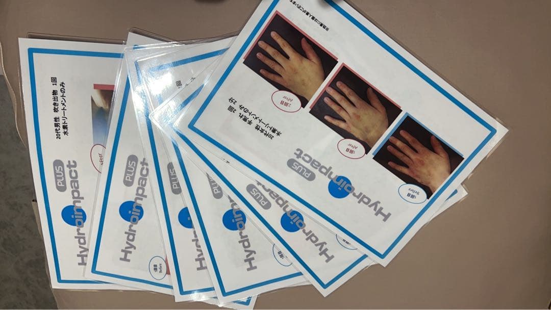 ハイドロインパクトプラス　毛穴洗浄　ハイドラフェイシャル　美容機器